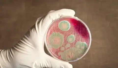 Сибирская язва в Байсерке: спокойствие под защитой научного щита Павлодаре