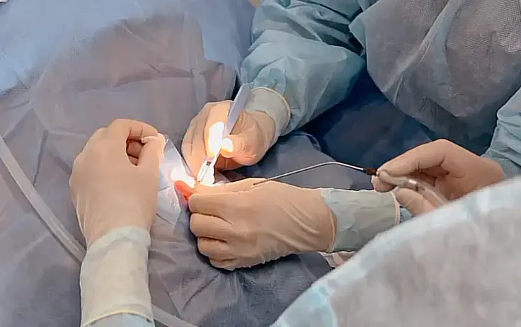 В Караганде впервые провели операцию по протезированию слуховой косточки (3)