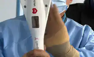 Сердечный ритм вновь зазвучал: НИИКВБ восстановил жизнь митральному клапану 71-летнего пациента