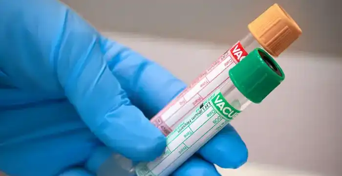 INVIVO Business: За пределами границ или злоупотребление? Павлодаре