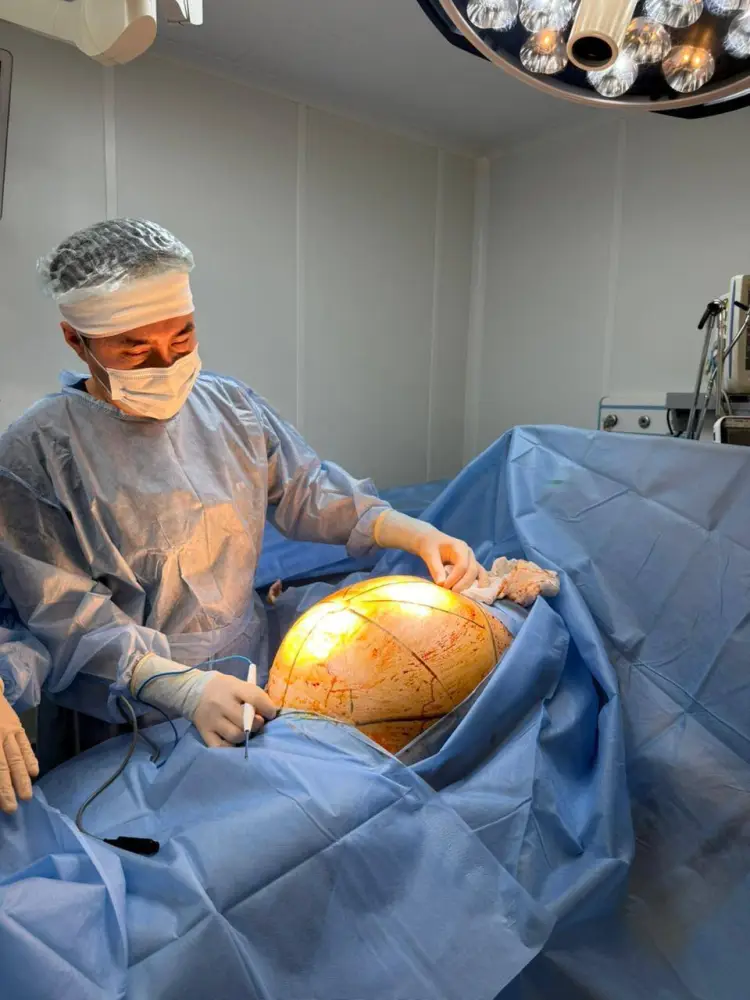 В АЛМАТЫ У ПАЦИЕНТКИ СМЕНИЛА СВОЮ СУДЬБУ ГИГАНТСКАЯ ОПУХОЛЬ В 25 КИЛОГРАММОВ Павлодаре