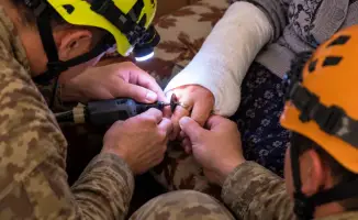 Павлодарские спасатели сняли кольцо с руки женщины в экстренной ситуации